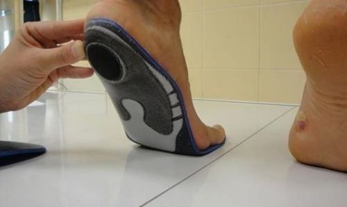 Что делать, если у вас выявлено плоскостопие при медосмотре